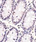 CDKN1A Antibody (C-term)